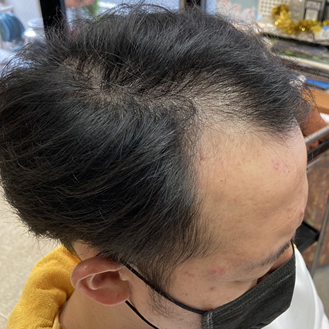 改善後