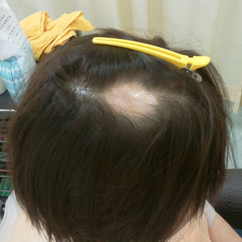改善前